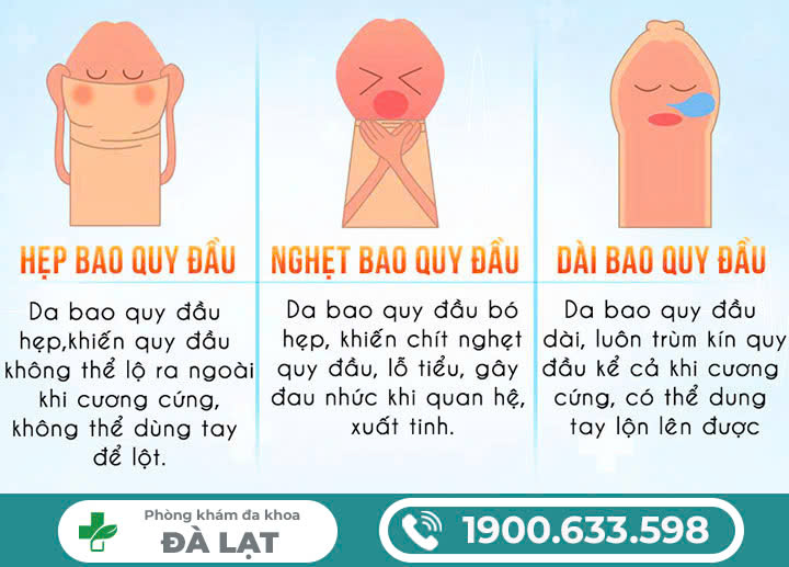Hình ảnh minh họa